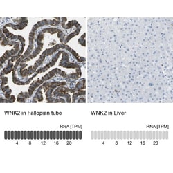 WNK2 Antibody, Novus Biologicals:Antibodies:Primary Antibodies
